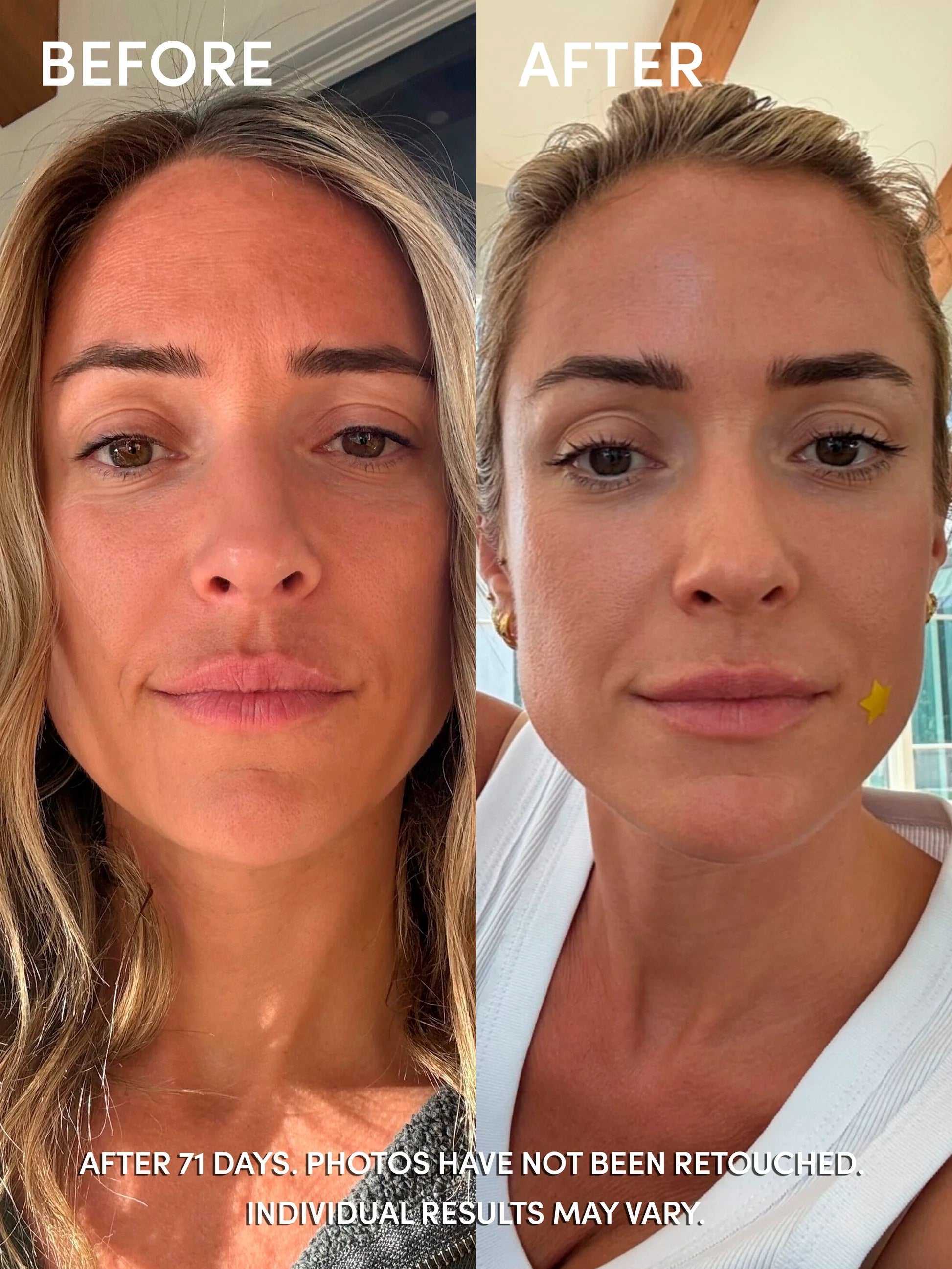 Before and after results 1