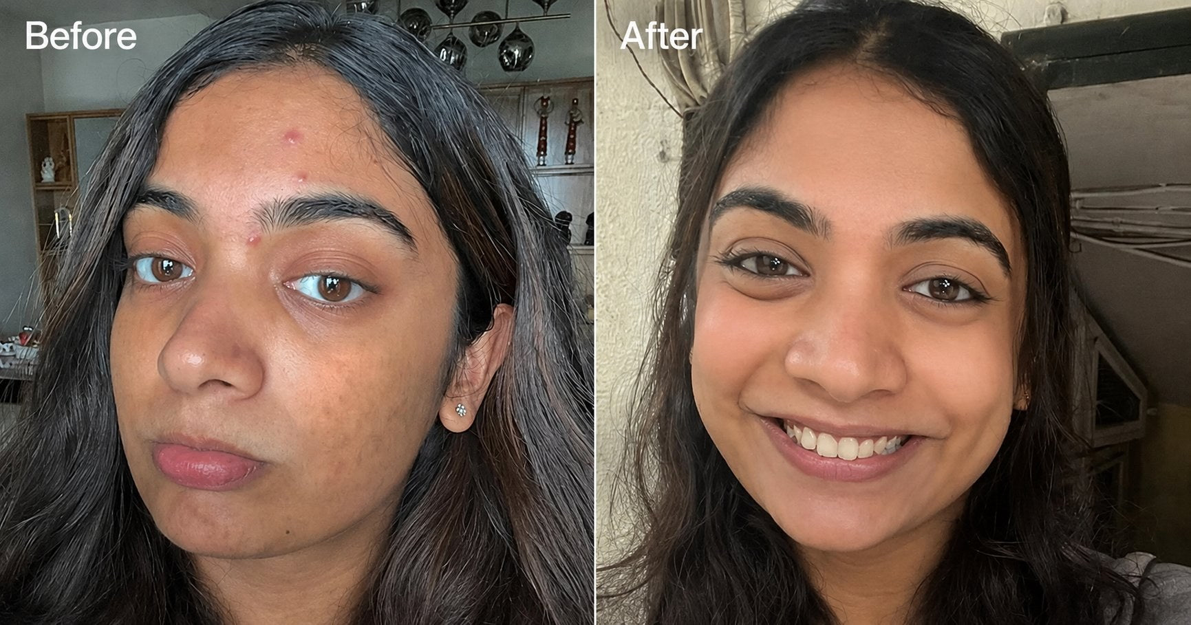 Before and after results 2