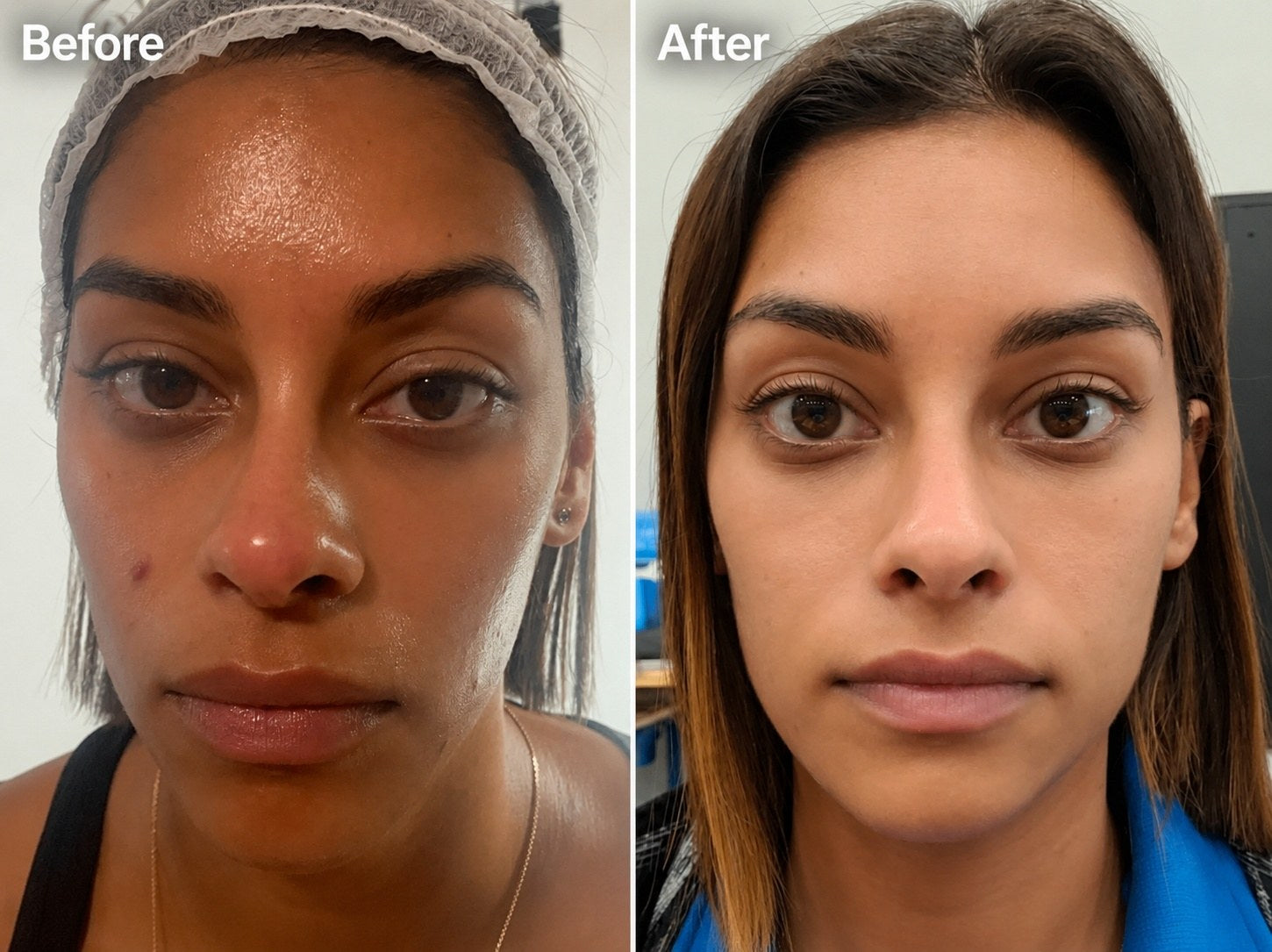 Before and after results 3