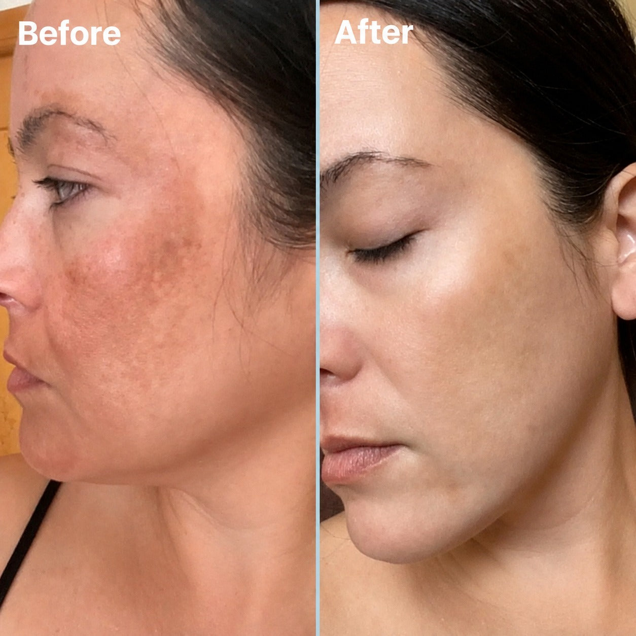 Before and after results 4